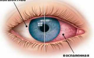 Глазные капли при травме глаза