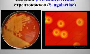 Стрептококк агалактия в мазке или моче у мужчин и женщин